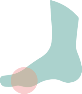 Un icono verde de un pie con un círculo rojo señalando la zona afectada por una duricia.
