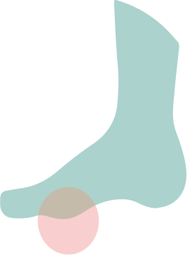 Un icono de un pie con una esfera roja que marca una zona afectada por un callo.