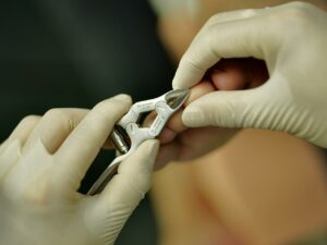 plano detalle de un podólogo cortando una uña del pie